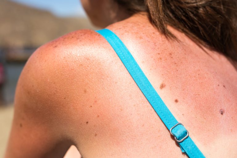 Here is a formal rewrite of the title:
The Disproportionate Engagement of Anti-Sunscreen Content on TikTok